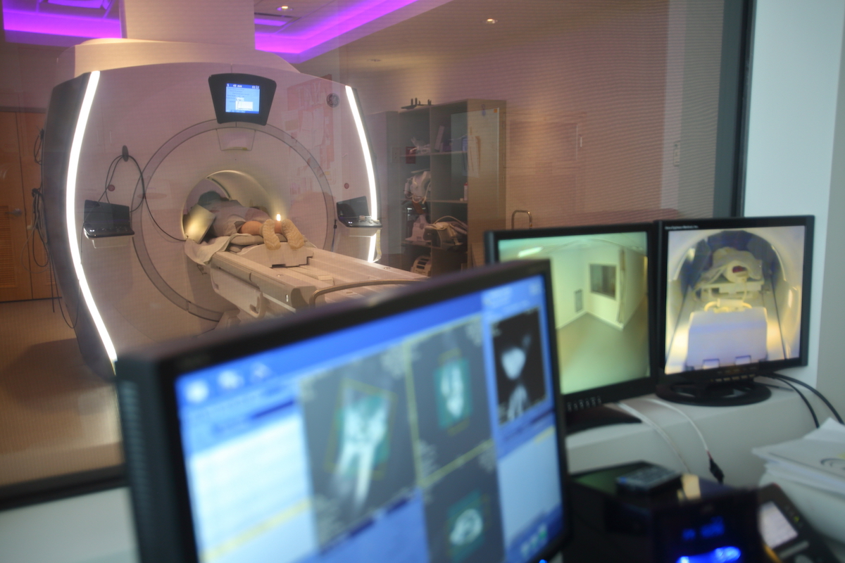 pmuc_mri_7